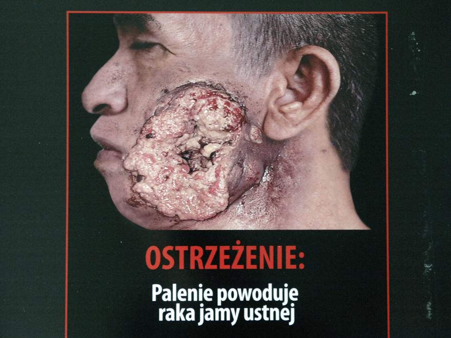 Z okazji Światowego Dnia Bez Tytoniu ministerstwo zdrowia zorganizowało wystawę grafik, jakie w różnych krajach straszą z paczek papierosów