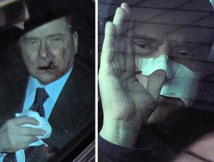 Berlusconi na stole operacyjnym. Przez cztery godziny